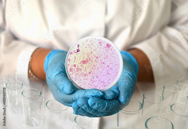 Fototapeta a girl in a medical gown and gloves holds a photo gonorrhea from a microscope in a round frame
