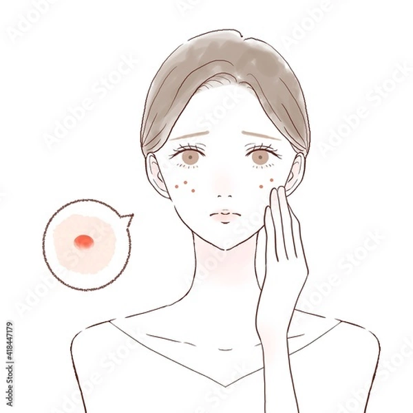 Obraz スキンケア　女性　ニキビ