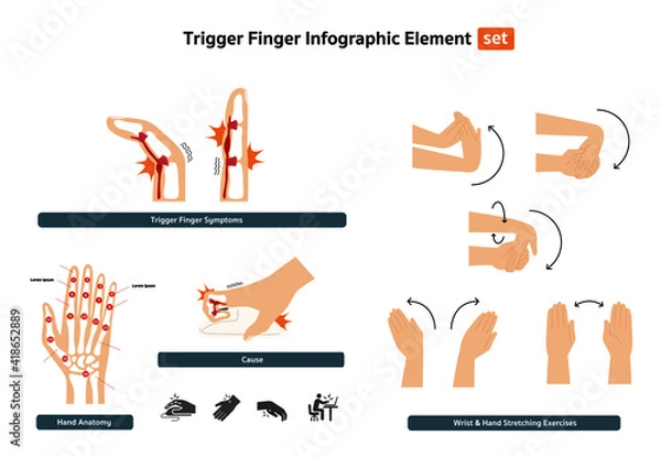 Fototapeta trigger finger infographic element set, office syndrome, finger abnormal symptoms from work with wrist and hand stretching exercises and icon set flat design
