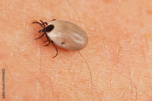 Obraz Zecke auf der Haut