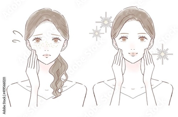 Obraz そばかす　女性　ビフォーアフター