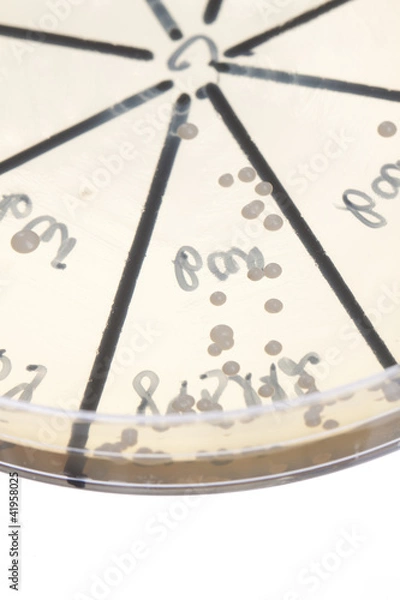 Obraz Bacteria on petri dish
