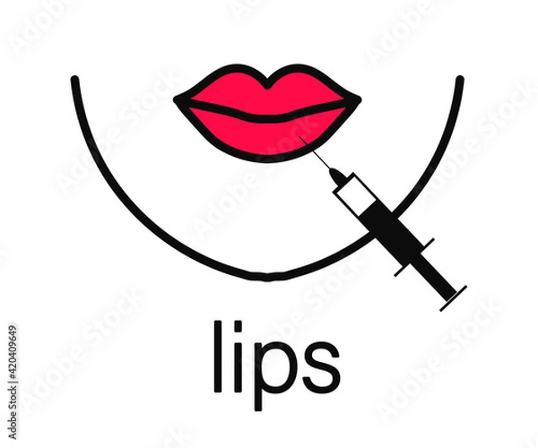 Fototapeta Lip augmentation with Botox. Beautiful lips and injection. Symbol. Vector illustration.