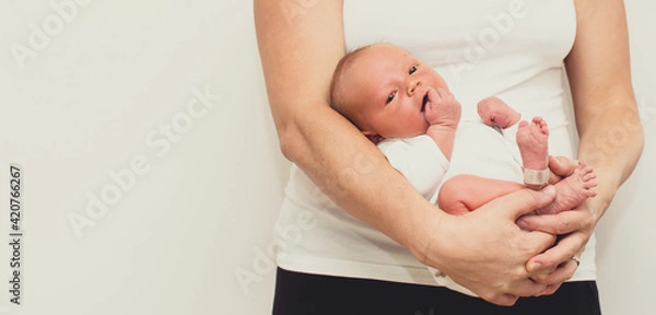Fototapeta Neonatal jaundice - yellowish discoloration of the white part of the eyes and skin in newborn baby. Mother hold baby in hands.