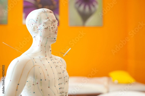 Fototapeta Akupunkturmann