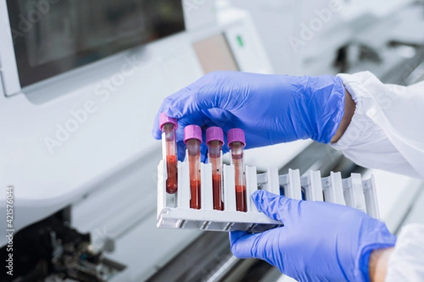 Fototapeta Scientist wear glove holding test tube in sample rack to check qulity of sample.