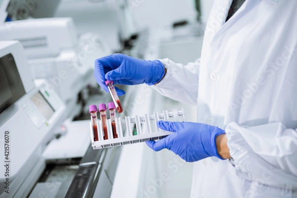 Fototapeta Scientist wear glove holding test tube in sample rack to check qulity of sample.