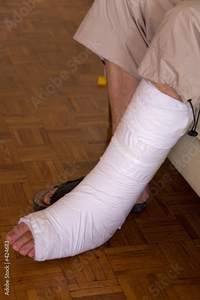 Obraz people 44 broken leg