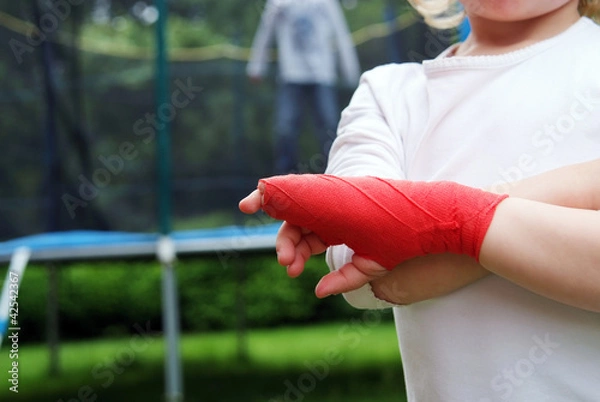 Obraz Trampolin Unfall Mädchen hat Finger gebrochen