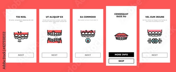 Fototapeta Tooth Braces Accessory Onboarding Mobile App Page Screen Vector. Tooth Braces Installation And Correction, Metal And Sapphire, Ceramic And Plastic Material Illustrations