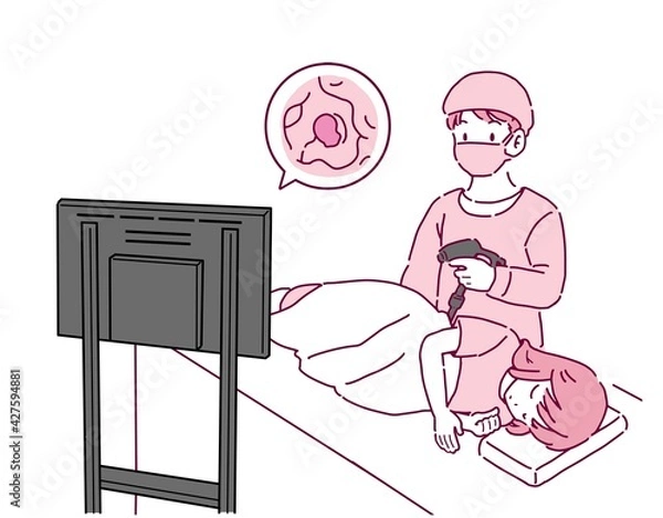 Obraz 大腸がん検査を行う女性と医者のイラスト