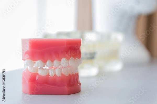 Fototapeta Dental model of invisible dental device to showcase to the custo