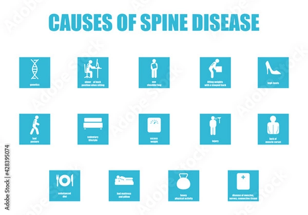 Fototapeta Causes of the spine disease. A set of icons on the topic of posture disorders. Medical infographics on the topic of scoliosis, lordosis, kyphosis