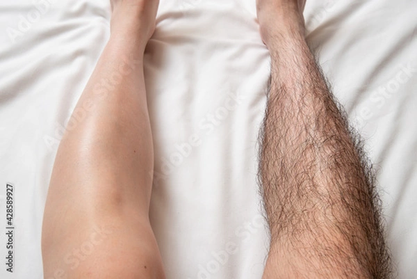 Obraz メンズ　脚脱毛　before & afterイメージ　片脚のみ