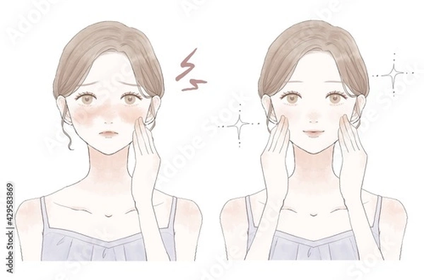 Obraz スキンケア　女性　赤み　ビフォーアフター