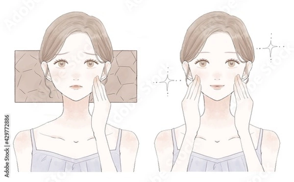 Obraz 女性　乾燥肌　ビフォーアフター