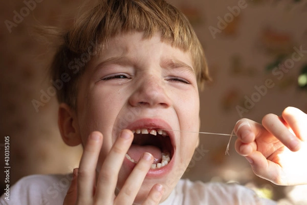 Fototapeta Portrait of boy upset by crying. Close-up of frustrated kid is sad and painful to remove baby teeth, screaming in pain.