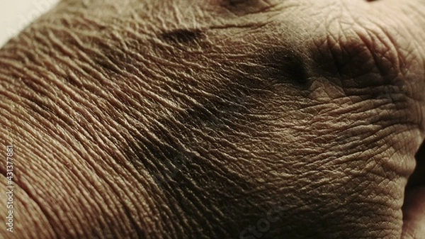 Fototapeta Close up of Senior's hands with Alzheimer disease