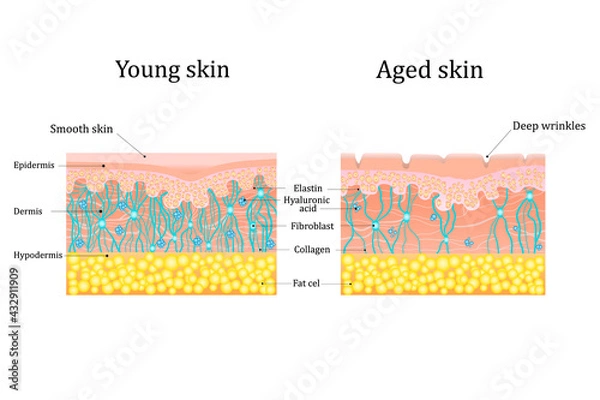 Fototapeta Vector illustration of age-related changes in the skin. Comparison of young and old skin. Structure human skin with collagen and elastin fibers, fibroblasts.