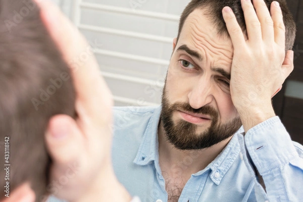 Obraz Man with a alcohol withdrawal syndrome and a headache looks in the mirror in the morning, portrait, close-up