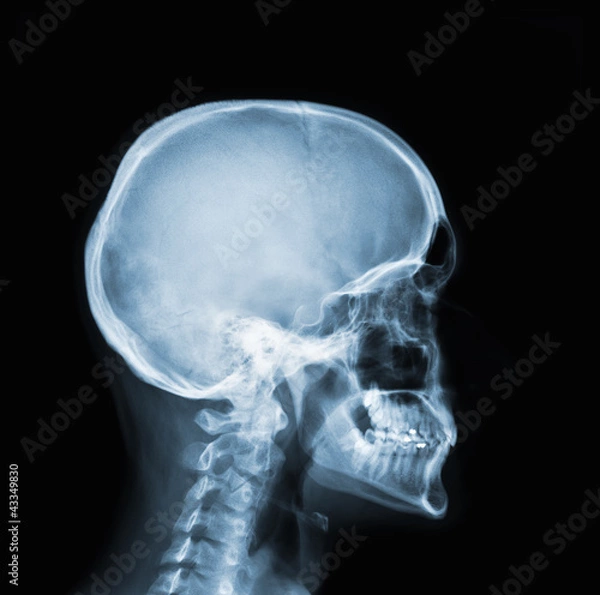 Obraz RTG głowy