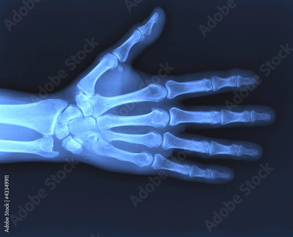 Obraz X-ray hand