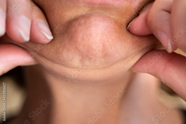 Obraz Face With Double Chin