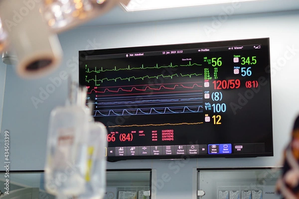 Obraz The screen showed monitoring vital sign during open heart surgery.