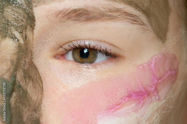 Fototapeta A closeup of a brown eye, with a different-colored grooming mask on the face