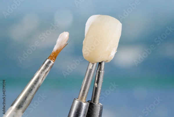 Obraz applying ceramic material on dental crown