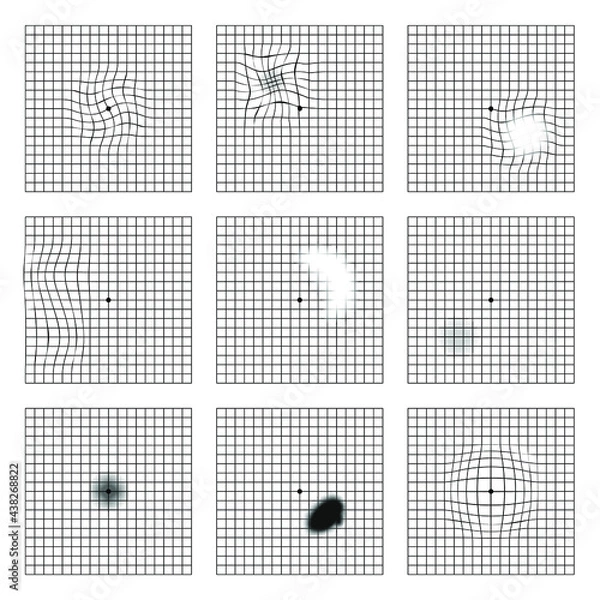 Obraz Amsler grid scotoma eye test.  Oculist Vector printable chart retina examination. Grid with dot in centre. Vision control.
