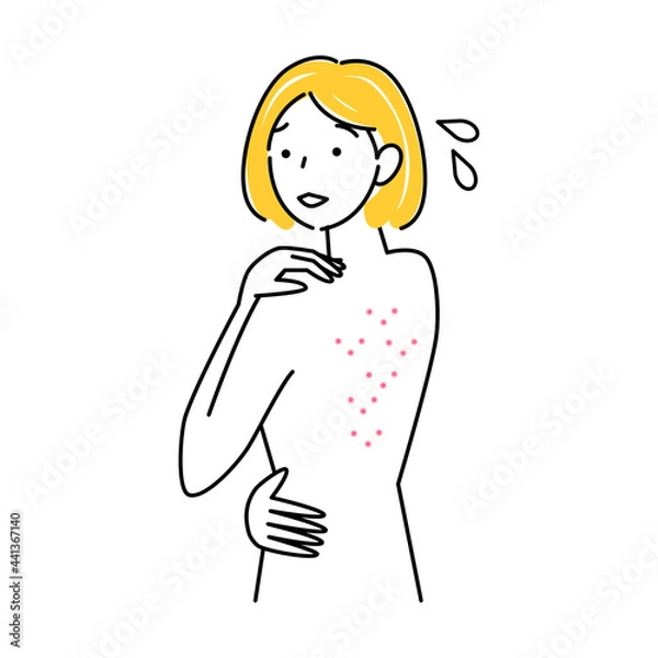 Fototapeta スキンケア 背中にポツポツ（吹き出物・ニキビ）が出来て悲しんでいる可愛い女性 イラスト シンプル ベクター