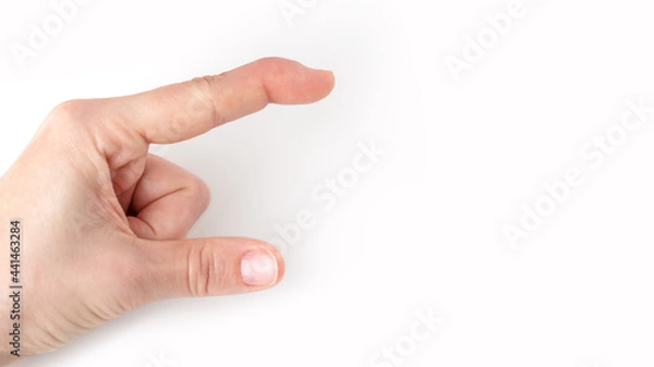Obraz part of left hand showing size, how big, long with index finger and thumb, index finger with a extensor tendon injury, mallet finger, tip bending downwards, deformity in the last phalangeal bone