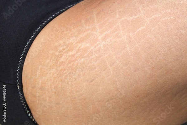 Fototapeta Rozstępy