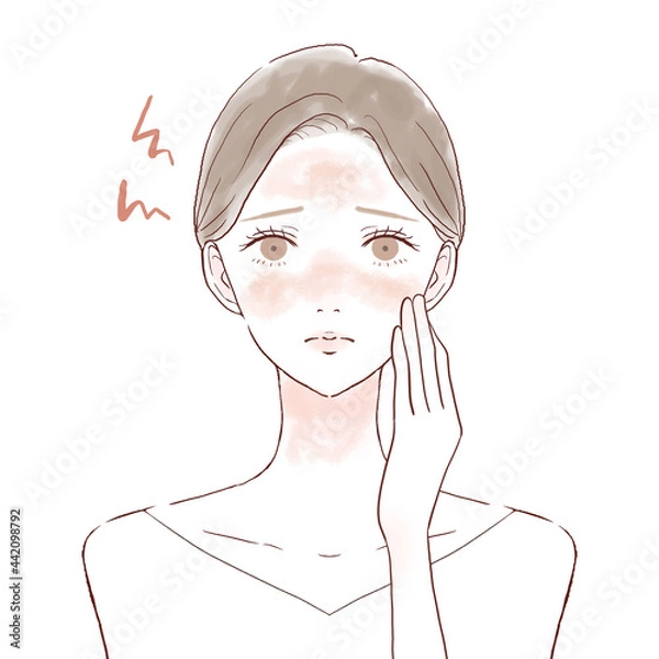 Obraz 肌の炎症に悩む女性