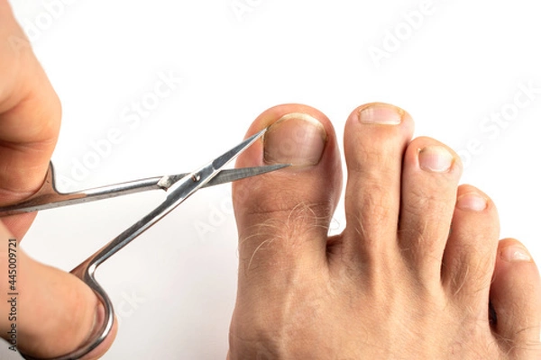 Obraz The guy cuts his toenails with scissors.