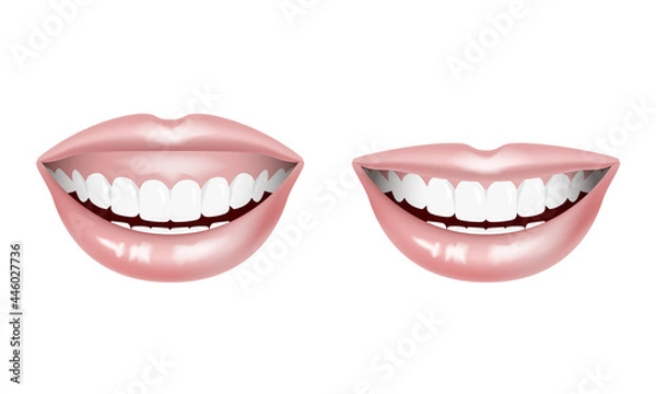 Obraz ガミースマイル