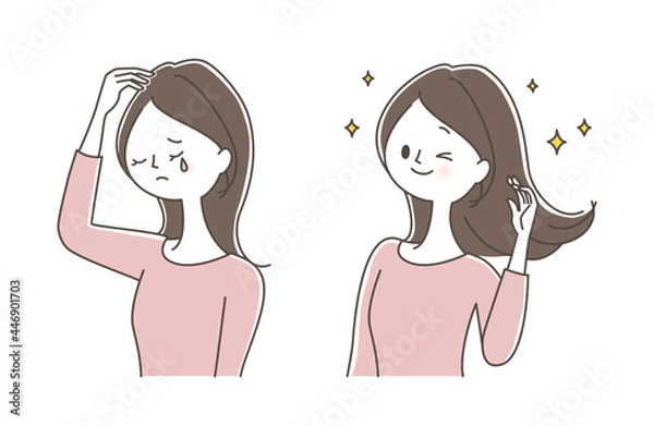 Obraz 薄毛で悩む若い女性　ビフォーアフター