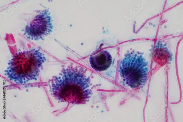 Obraz Aspergillus (mold) under the light microscopic view.