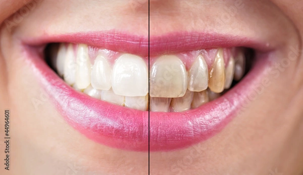 Obraz Czyszczenie zębów.