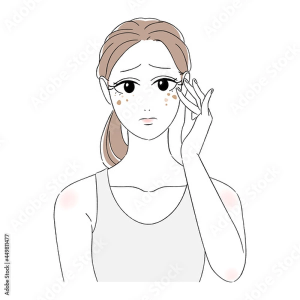 Obraz 女性　美肌　肌トラブル　美容　スキンケア　シミ　老人性色素斑　肝斑　悩む顔　困り顔　タンクトップ