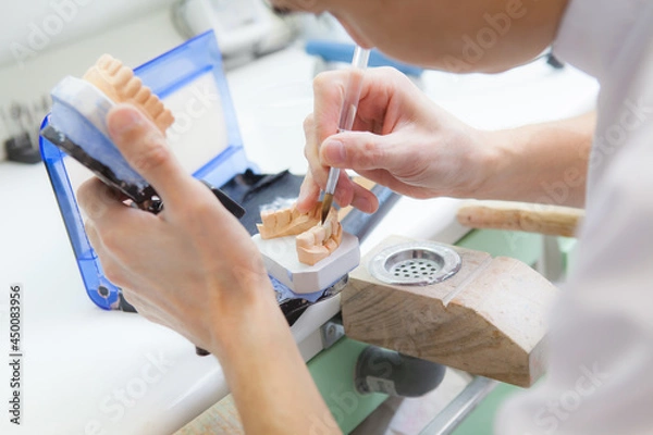 Fototapeta Technician dental is working with complete lower and upper metal ceramic prosthesis dental. Dental technician works by brush with jaw model