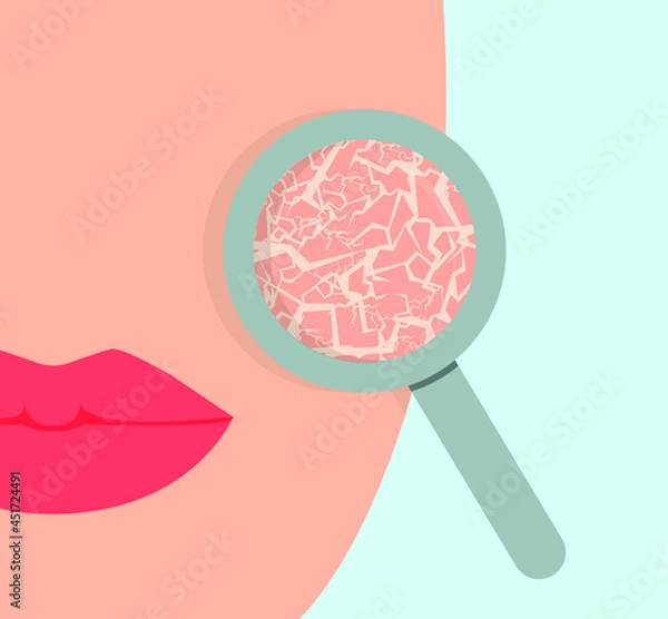 Fototapeta Dry skin of the girl's face through a magnifying glass. Concept: skin problems, care and cosmetics. Vector illustration, flat cartoon color minimal design, eps 10.