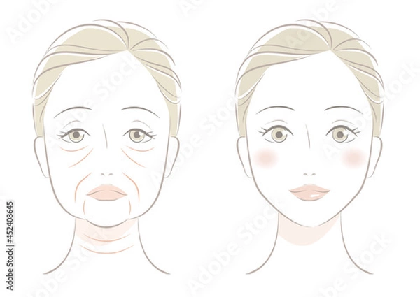 Obraz 顔のたるみ