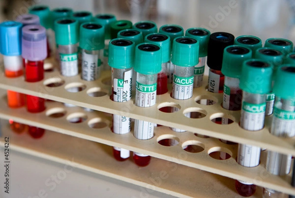 Obraz Tubes à essai