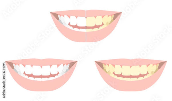 Obraz 歯の色（白～黄色）まとめ