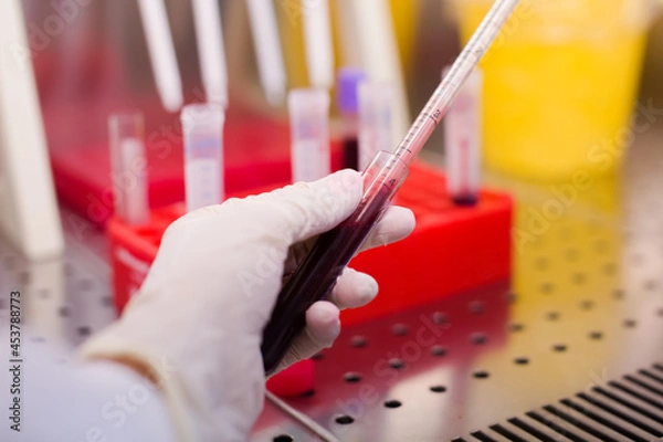 Fototapeta Laboratory technician isolates blood cells