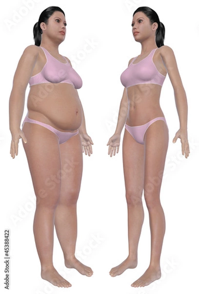 Obraz Weight Loss Before And After Angled Front View