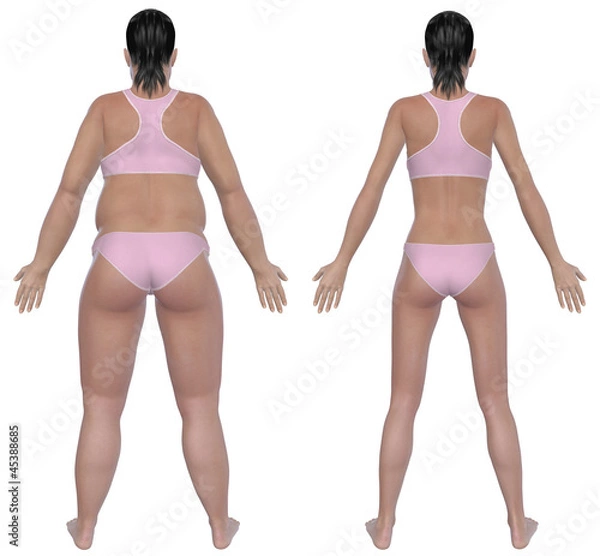 Obraz Weight Loss Before And After Rear View