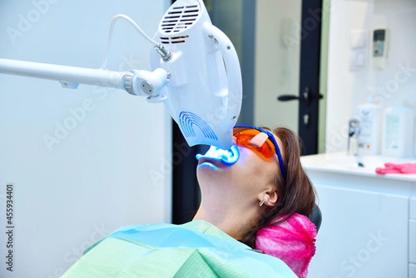 Obraz Teeth whitening procedure with ultraviolet light lamp.